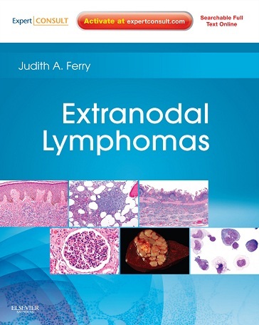 Extranodal lymphomas