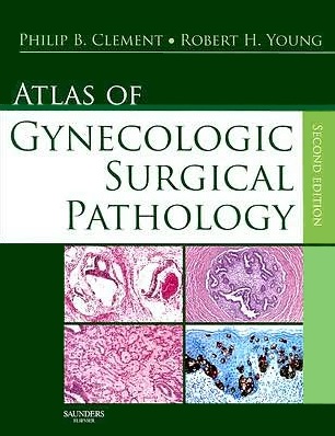 Atlas of gynecologic surgical pathology