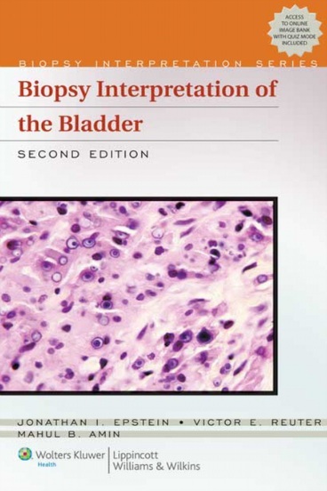 Biopsy Interpretation Of The Bladder 2nd Edition Basic Medical Books