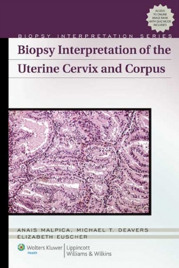 Biopsy interpretation of the uterine cervix and corpus