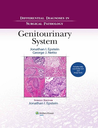 Differential Diagnoses in Surgical Pathology Genitourinary System