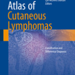 Atlas of Cutaneous Lymphomas                                                    :                             Classification and Differential Diagnosis
