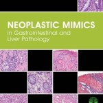 Neoplastic Mimics in Gastrointestinal and Liver Pathology