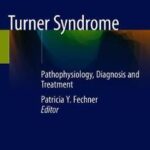 Turner Syndrome : Pathophysiology, Diagnosis and Treatment