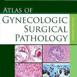 Atlas of Gynecologic Surgical Pathology, 2nd Edition