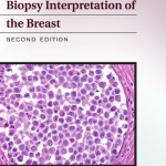Biopsy Interpretation of the Breast, 2nd Edition PDF