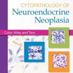 Cytopathology of Neuroendocrine Neoplasia: Color Atlas and Text Retail PDF