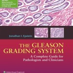 The Gleason Grading System: A Complete Guide for Pathologist and Clinicians