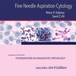 Fine Needle Aspiration Cytology: A Volume in Foundations in Diagnostic Pathology