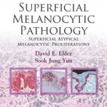 Superficial Melanocytic Pathology