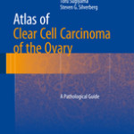 Atlas of Clear Cell Carcinoma of the Ovary