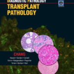 Diagnostic Pathology: Transplant Pathology: Published by Amirsys
