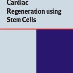 Cardiac Regeneration Using Stem Cells