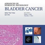 Advances in Surgical Pathology: Bladder Cancer