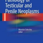 Pathology of Testicular and Penile Neoplasms 2016