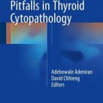 Common Diagnostic Pitfalls in Thyroid Cytopathology 2016