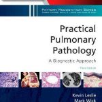 Practical Pulmonary Pathology: A Diagnostic Approach : A Volume in the Pattern Recognition Series