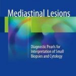 Mediastinal Lesions : Diagnostic Pearls for Interpretation of Small Biopsies and Cytology