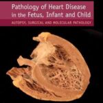 Pathology of Heart Disease in the Fetus, Infant and Child : Autopsy, Surgical and Molecular Pathology