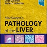 MacSween’s Pathology of the Liver